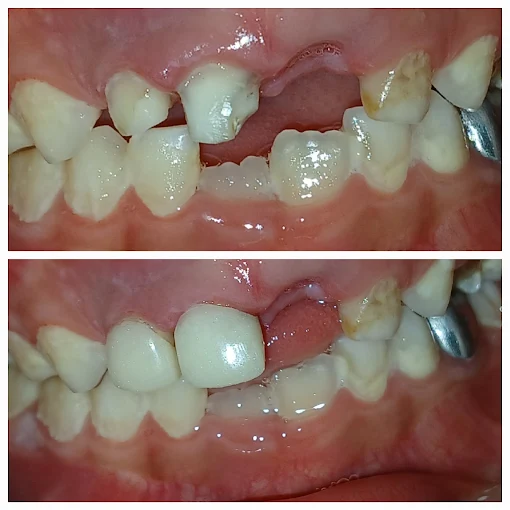Pooja Smile Care Dental Gallery Image 29
